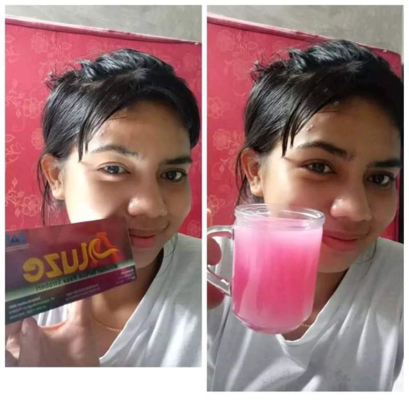 

Aluze / Gastritis Peradangan dinding lambung / GERD asam lambung / Tukak lambung / Gastroparesis BPOM MUI HALAL