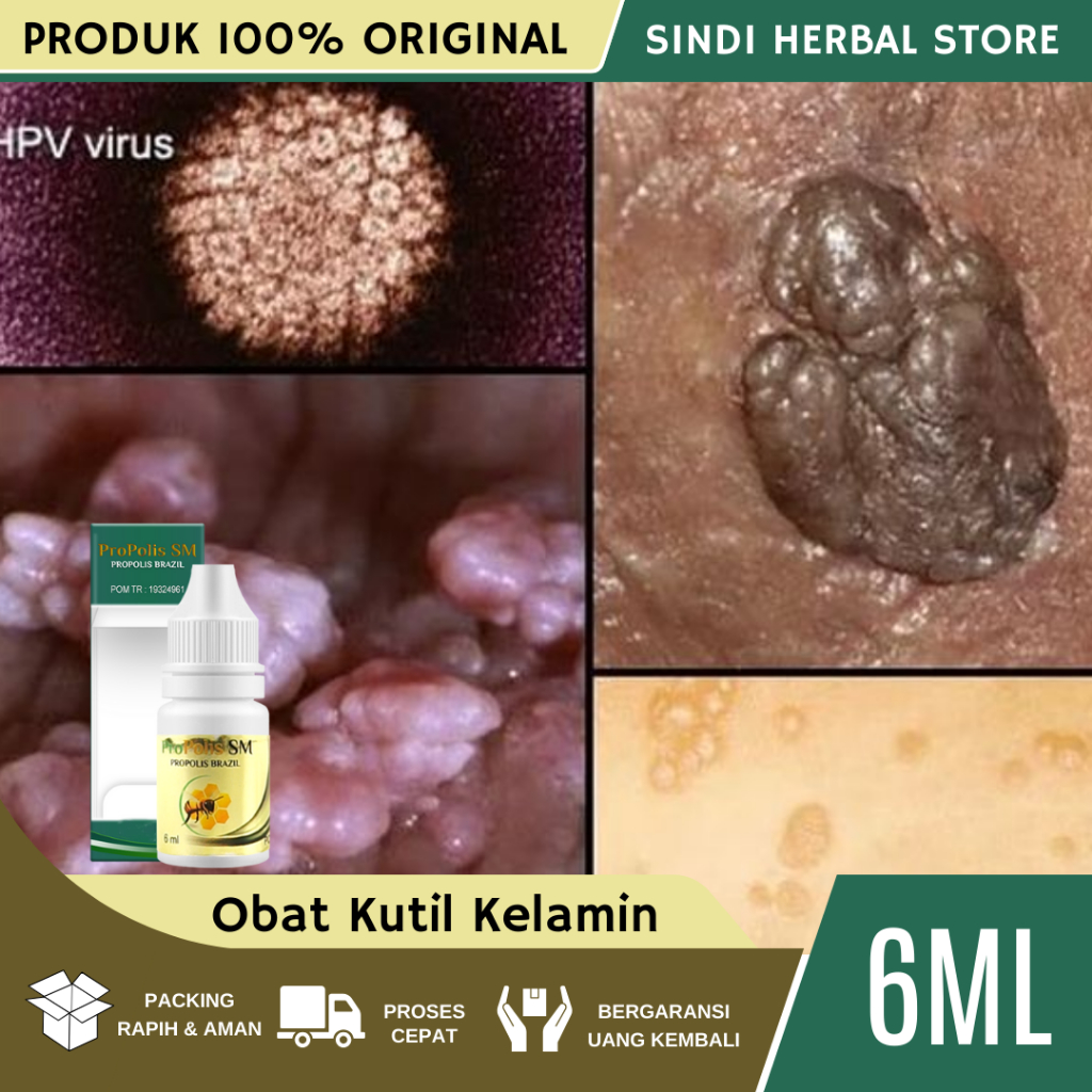 Obat Kutil, Obat Kutil Kelamin, Obat Kutil Kelamin Laki Laki, Obat Kutil Kelamin Wanita, Obat Penghi
