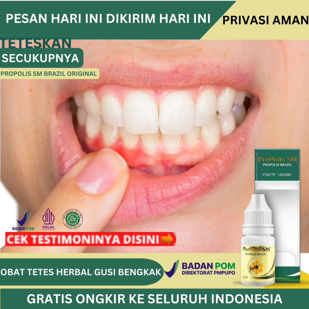 Obat Gusi Bengkak, Obat Gusi Turun, Resesi Gusi, Gusi Berdarah, Radang Gusi, Obat Nyeri Gigi Dan Gus