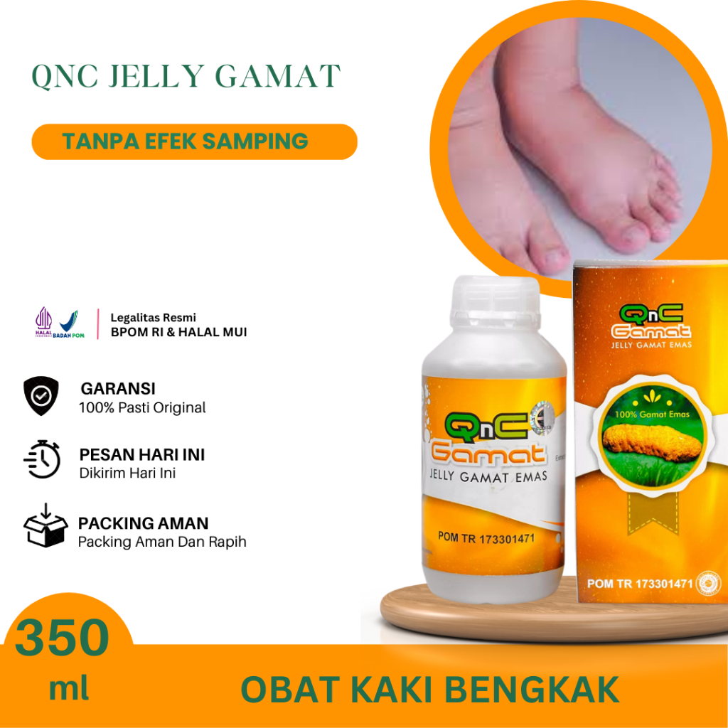 Obat Kaki Bengkak, Kaki Bengkak Kesemutan, Bengkak Karena Jatuh, Jantung Kaki Bengkak, Kaki Bengkak 