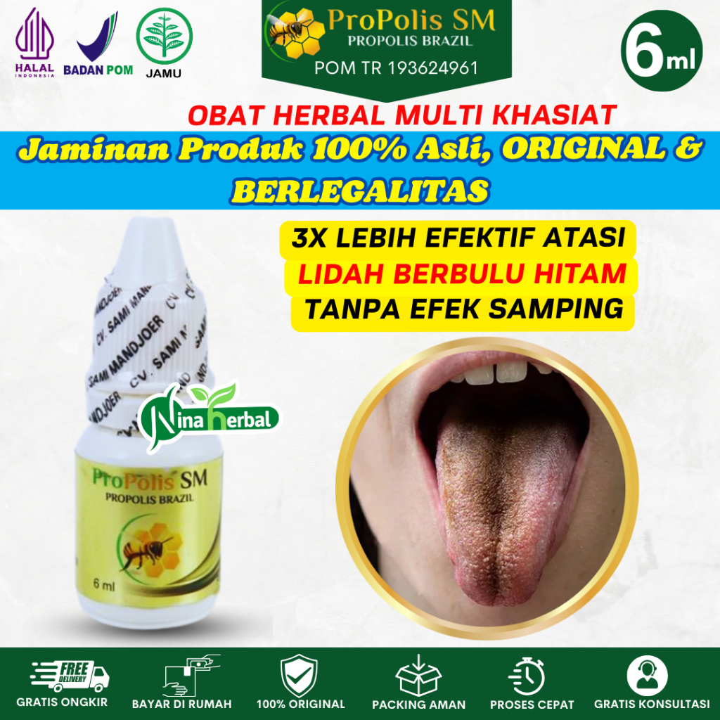 Obat Lidah Berbulu Hitam, Obat Black hairy tongue, Obat Lidah Hitam Dan Berbulu, Obat Lidah terlihat