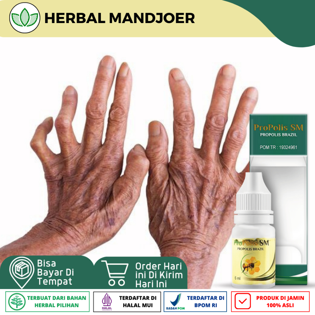 Obat Kusta/ Lepra, Kusta Kering/ Basah, Obat Kulit Mati Rasa, Obat Luka Menebal, Obat Kusta Gatal, P