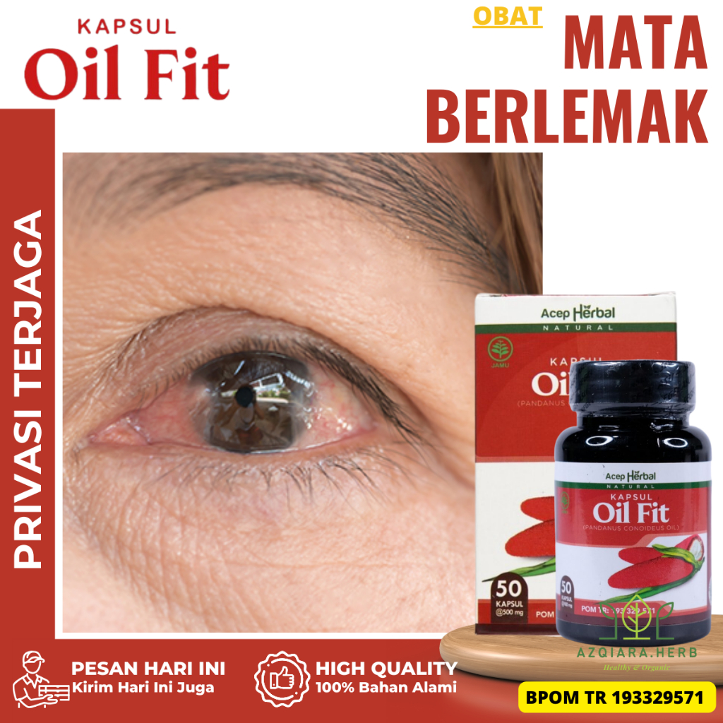 Obat Mata Berlemak, Obat Penghilang Lamad Mata, Obat Mata Pterygium, Obat Mata Berlemak Kekuningan, 