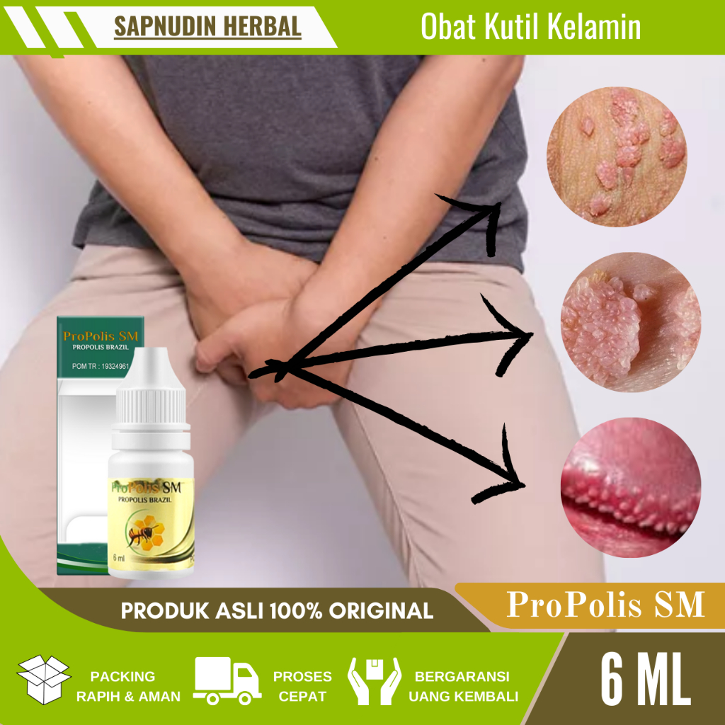 Obat Kutil Kelamin - Obat Kutil Kelamin Laki Laki - Obat Kutil Kelamin Wanita - Obat Kutil Kelamin A