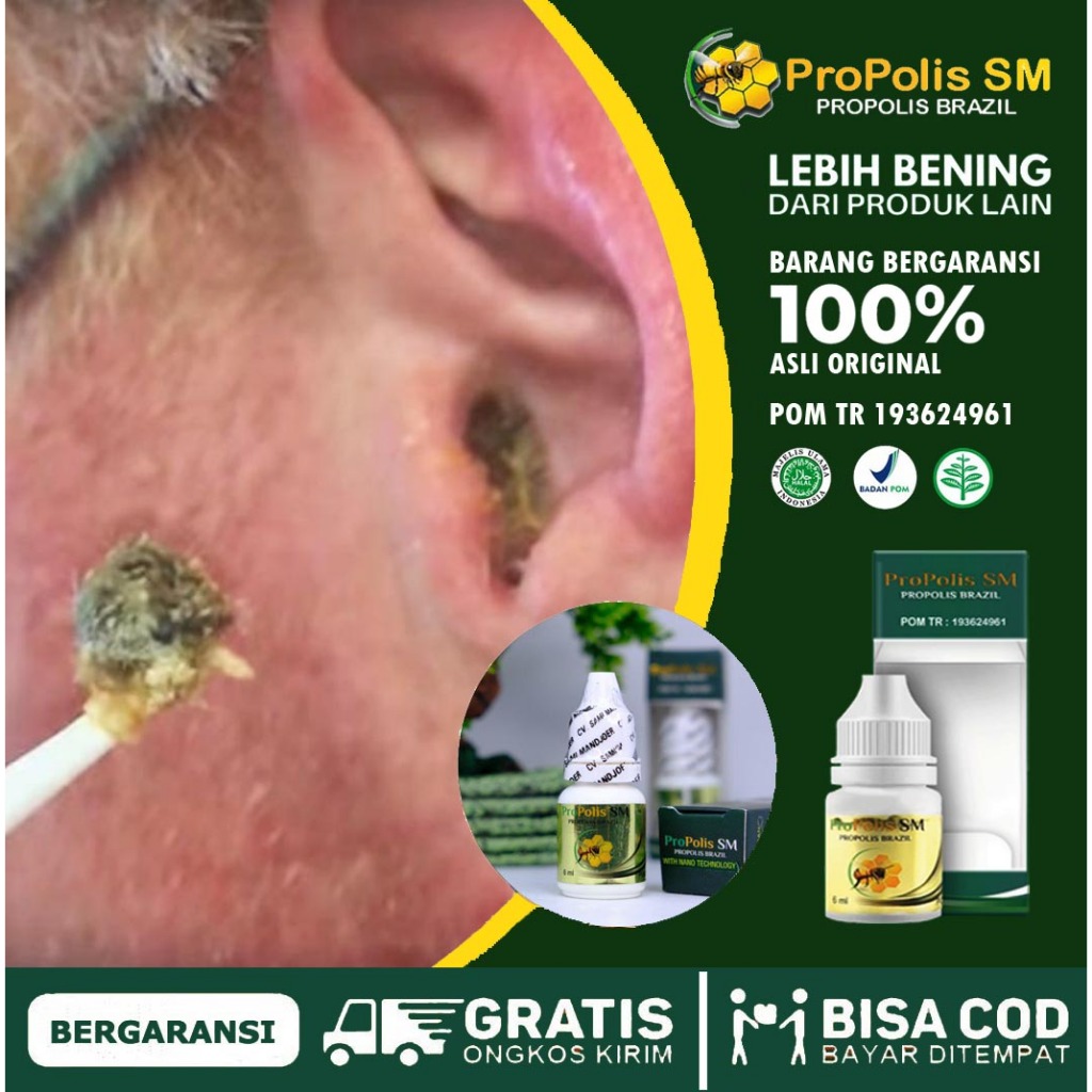 obat Tetes kuping, Obat Tetes Kotoran Kuping, Mengatasi Kotoran telinga keras, Kotoran telinga kerin