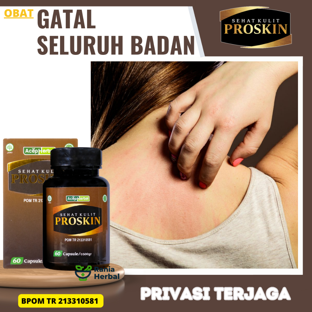 Obat Gatal Seluruh Badan, Obat Gatal Di Badan, Obat Gatal Ruam, Obat Gatal Bentol, Obat Gatal Bidura