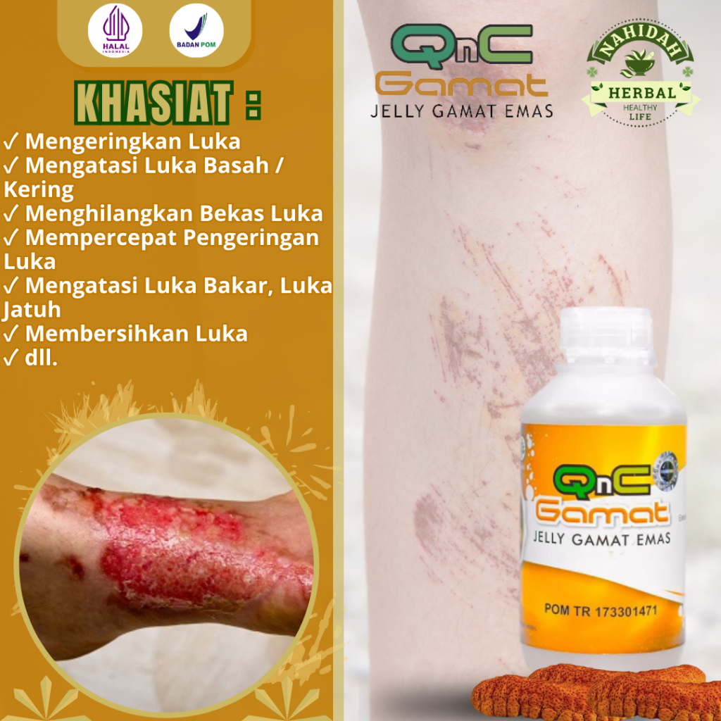 Obat Luka, Pengering Luka, Obat Luka Bakar, Luka Jatuh, Obat Luka Basah, Luka Kering, Obat Pembersih