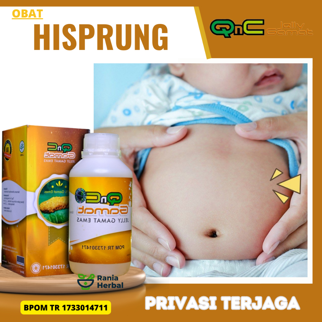 Obat Hisprung Pada Anak, Obat Susah BAB,  Obat Gangguan Usus Besar, Obat Sembelit Berkepanjangan, Ob