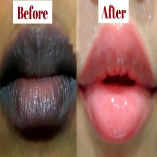 krim pelembab bibir hitam jadi merah bibir yang hitam perokok pria Krim pemutih bibir gelap perawata
