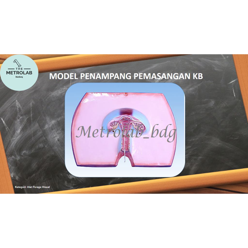 Model Penampang Pemasangan Spiral Keluarga Berencana (KB) | Spiral Installation Model