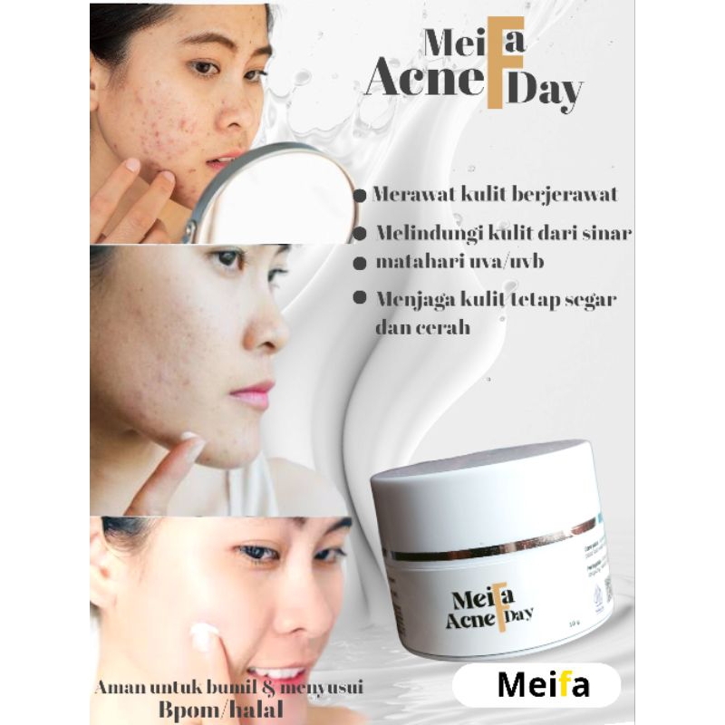 MEIFA Skincare acne day cream pagi/siang  menghilangkan jerawat  menjaga&merawat kulit berjerwat  wa