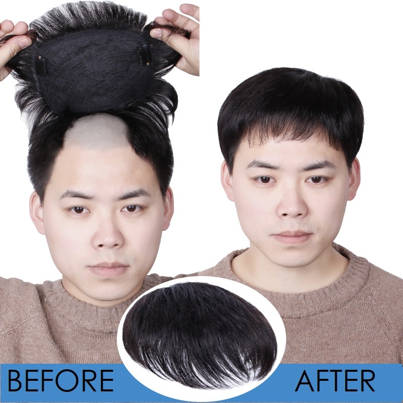 WIG TOUPEE / RAMBUT PALSU PENUTUP BOTAK PRIA COWOK PRIA / LAKI - LAKI 012 RSW REAL HUMAN HAIR