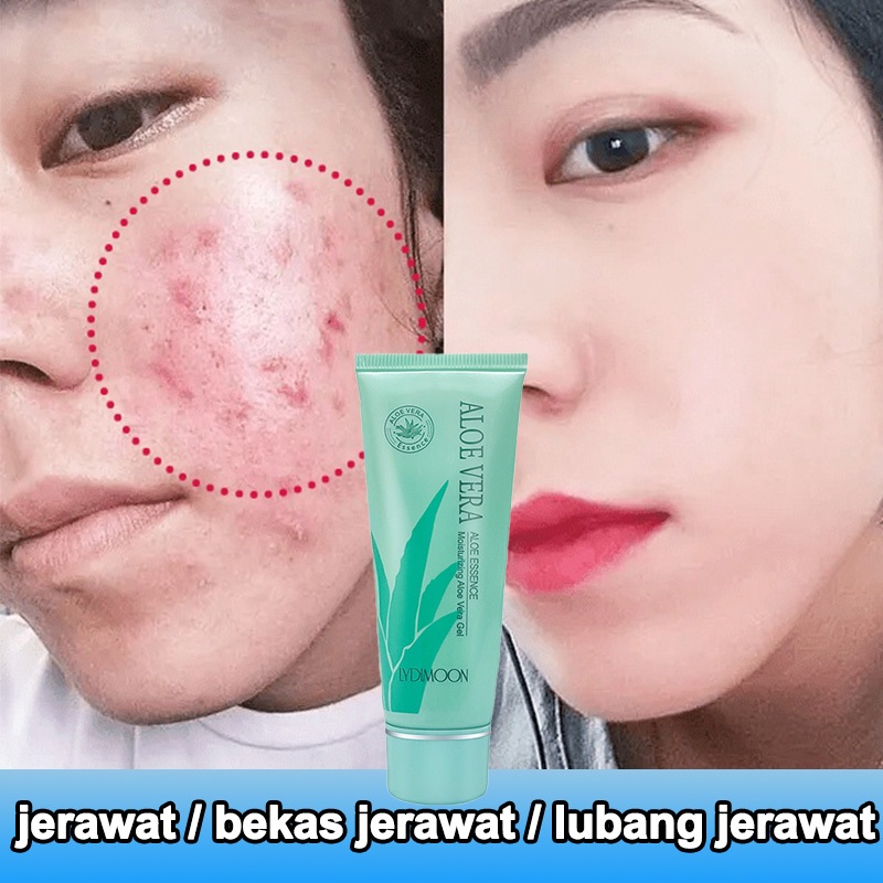 SScntx- Aloe vera soothing gel ekstrak lidah buaya melembabkan kulit 100% ekstrak lidah buaya