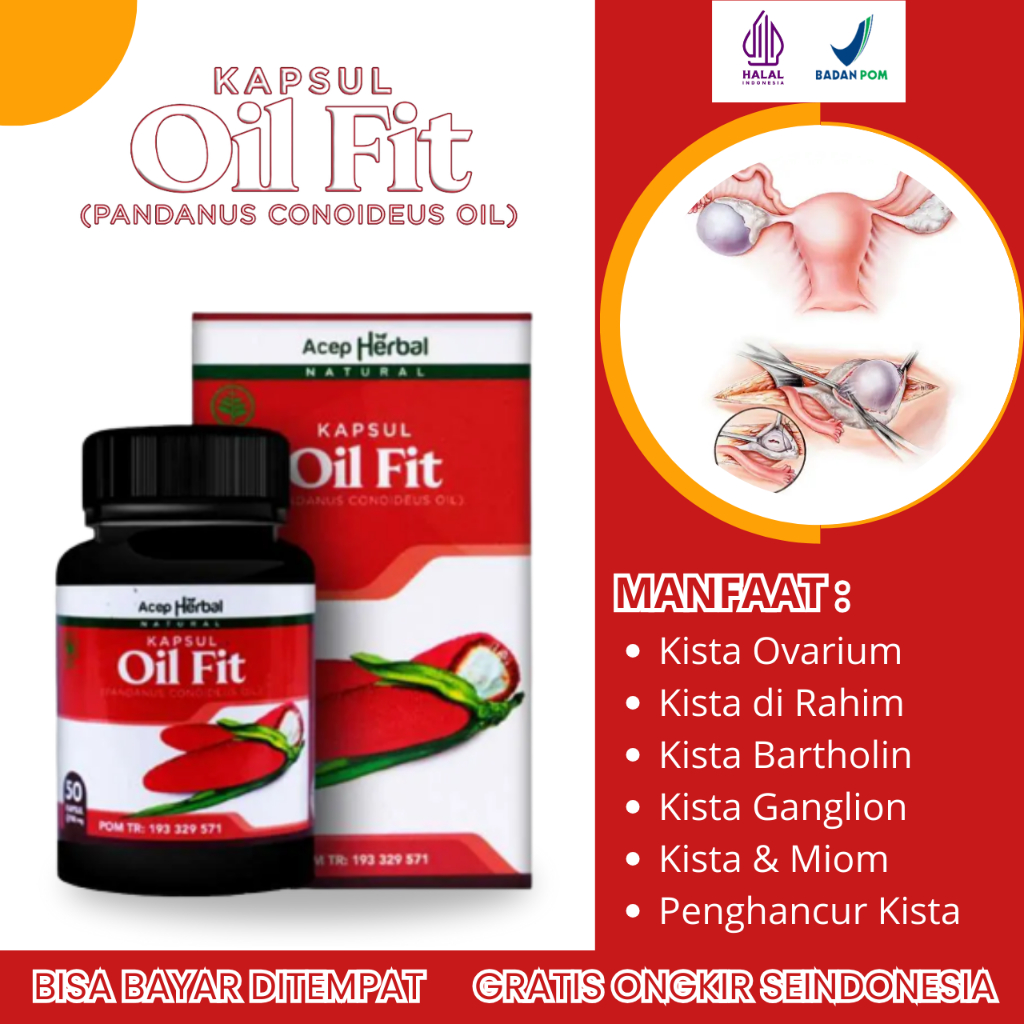 Obat Kista, Obat Kista Ovarium, Obat Kista di Rahim, Obat Kista Ganglion, Obat Kista Dermoid, Obat K