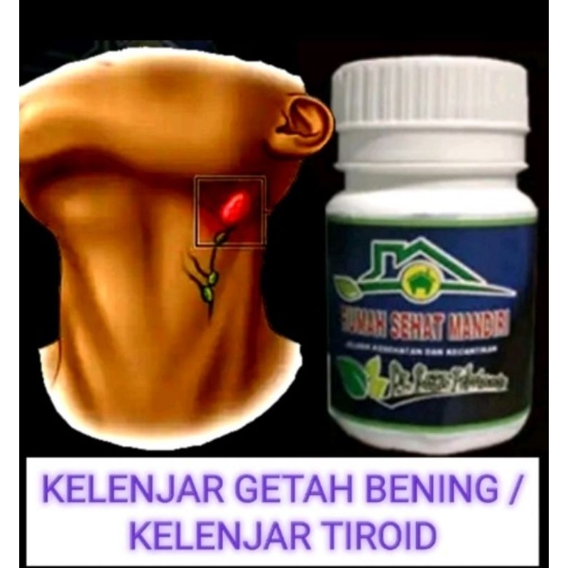 Obat Hipertiroid Tiroid Membengkak Kelenjar Tiroid, Gondok, Limfoma, getah bening