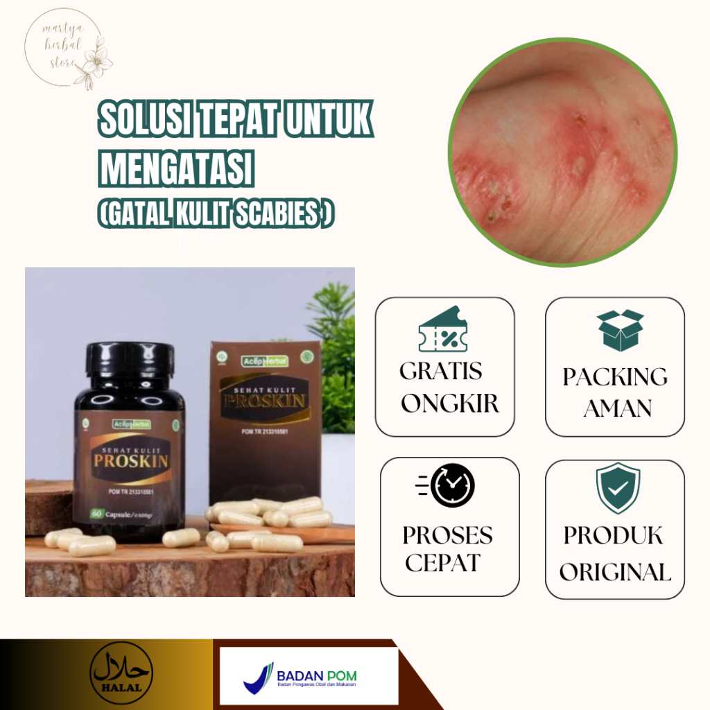 Obat Kudis Scabies, Manusia, Obat Budug Kudis, Obat Scabies Menahun, Obat Budug Bernanah, Obat Penge