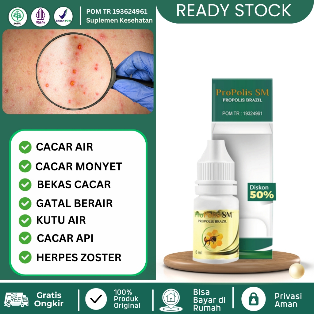 Propolis SM - Obat Cacar Air & Bekas Cacar, Obat Herpes Zoster, Obat Gatal Berair, Obat Kutu Air, Ob