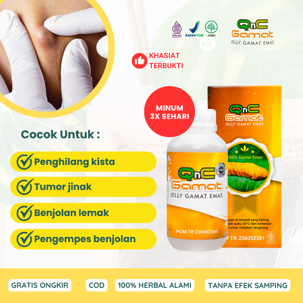 Obat Herbal Kista, Penghilang Kista Ovarium, Kista Baker, Kista Ginjal, Kista Ganglion, Kista Dermoi