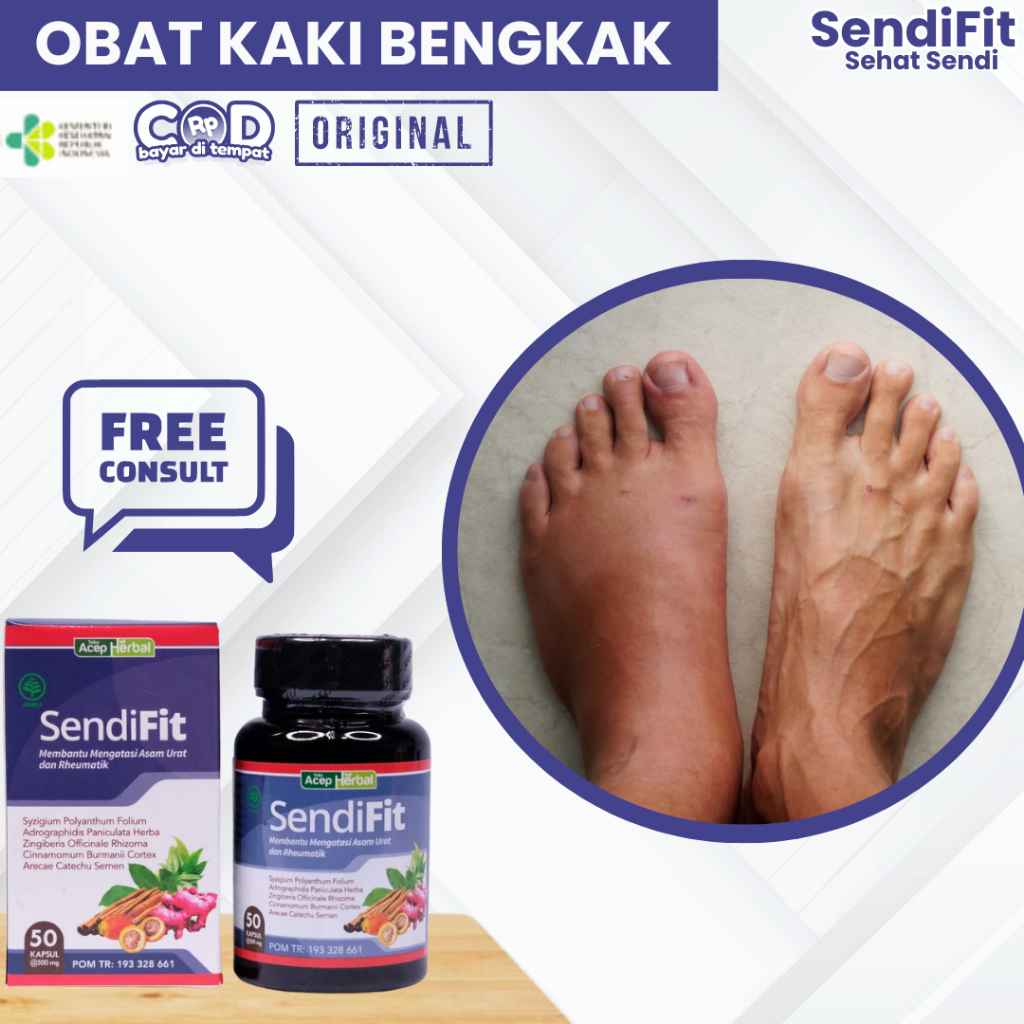 Obat Kaki Bengkak, Obat Kaki Bengkak Dan Nyeri, Obat Kaki Bengkak Sebelah Kanan/ Kiri, Edema Kaki, A