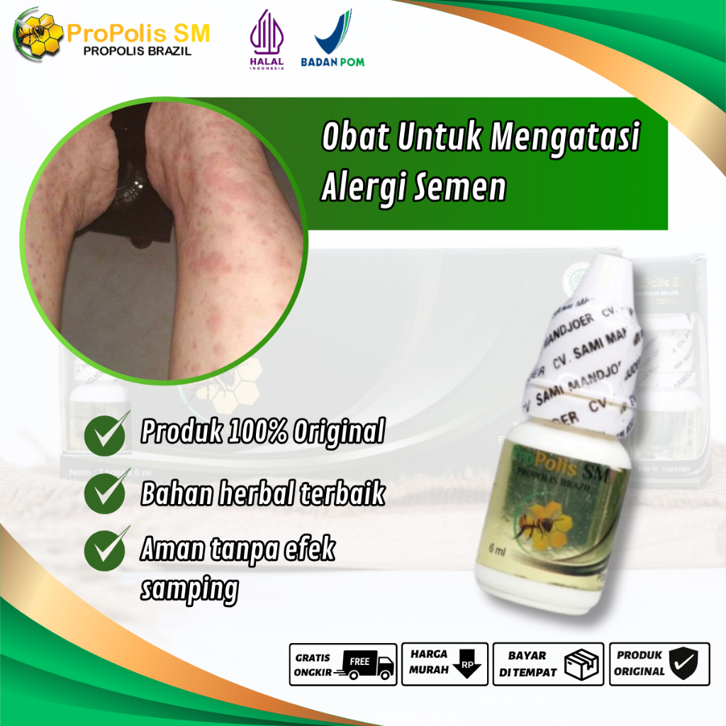 Obat Alergi Semen Alami, Kulit Gatal-Gatal Karena Alergi, Biduran, Kulit Ruam Kemerahan Karena Alerg