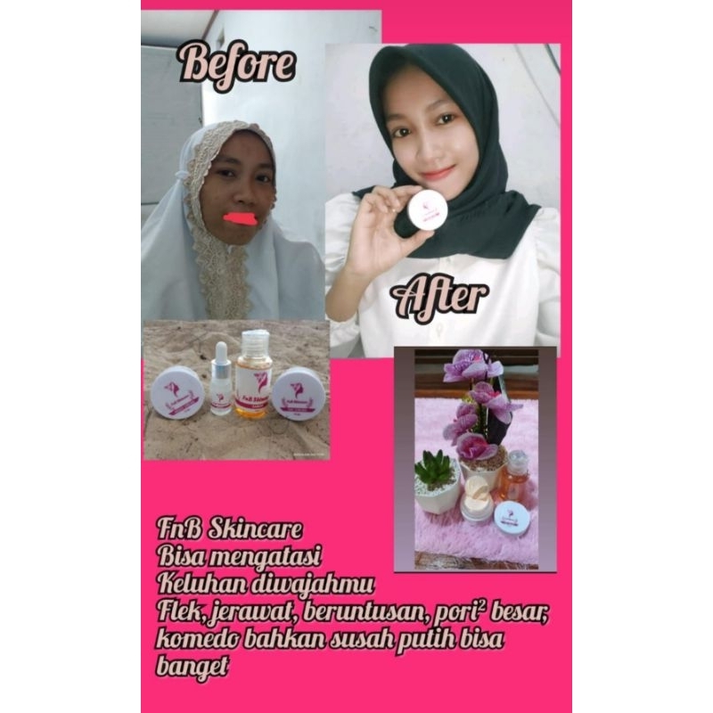 Cream FnB Skincare  Sejuta Manfaat bestiieee *Membuat wajah putih natural *Mnghilangkan flek hitam, 