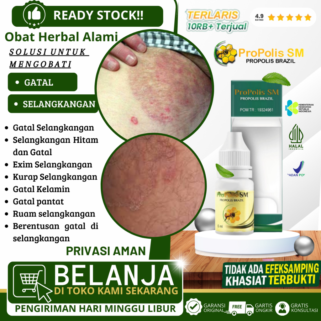 Obat Gatal Selangkangan Karena Jamur Pria Dan Wanita, Obat Selangkangan Hitam dan Gatal, Exim Selang