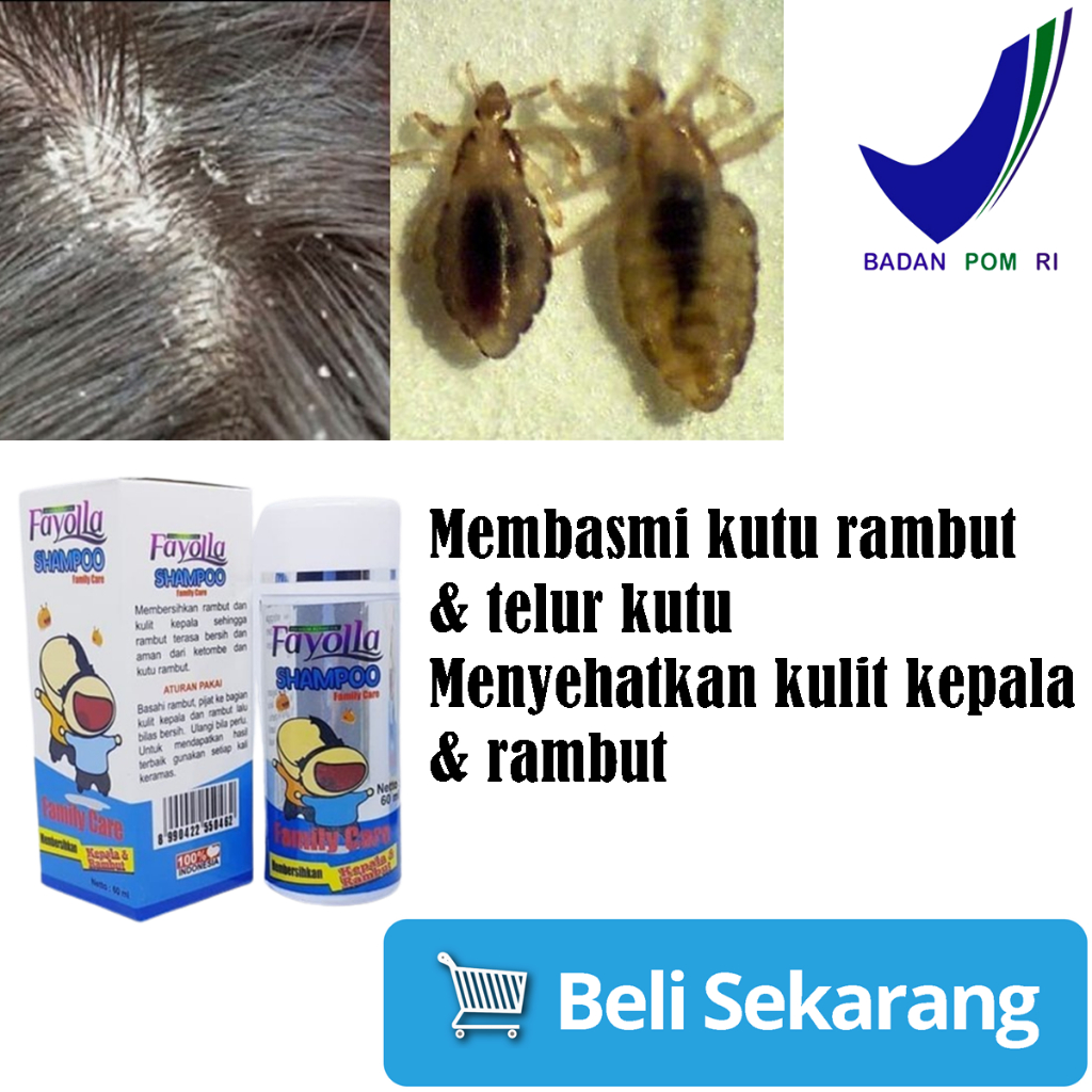 SAMPO KUTU RAMBUT ANAK AMPUH FAYOLLA PENGHILANG KUTU PERAWATAN RAMBUT Obat Kutu Rambut Dan Telurnya