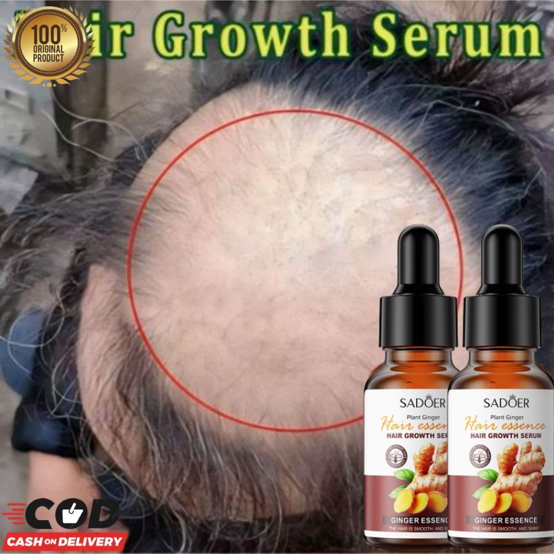 Hair Growth Serum Penumbuh Rambut Anti Rontok Obat rambut botak PENUMBUH RAMBUT Cairan serum penumbuh rambut botak penumbuh rambut botak obat penumbuh rambut botak pria rambut rontok parah