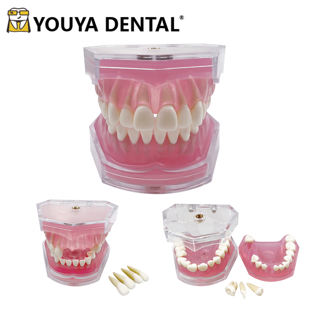 Dental study model typodont gigi bisa dilepas phantom studi edukasi gusi karet soft rubber gingiva