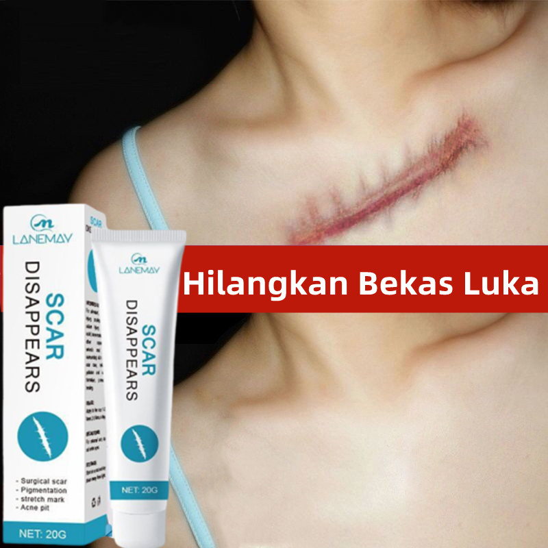 Minyak kuda 30g untuk mengobati tangan dan kaki pecah-pecah/tangan dan kaki kering dan mengelupas/kr