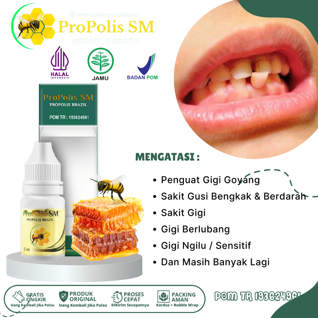 Obat Gigi Goyang, Obat Penguat Gigi Goyang, Obat Nyeri Gusi Bengkak, Obat Sakit Gigi Berlubang, Obat