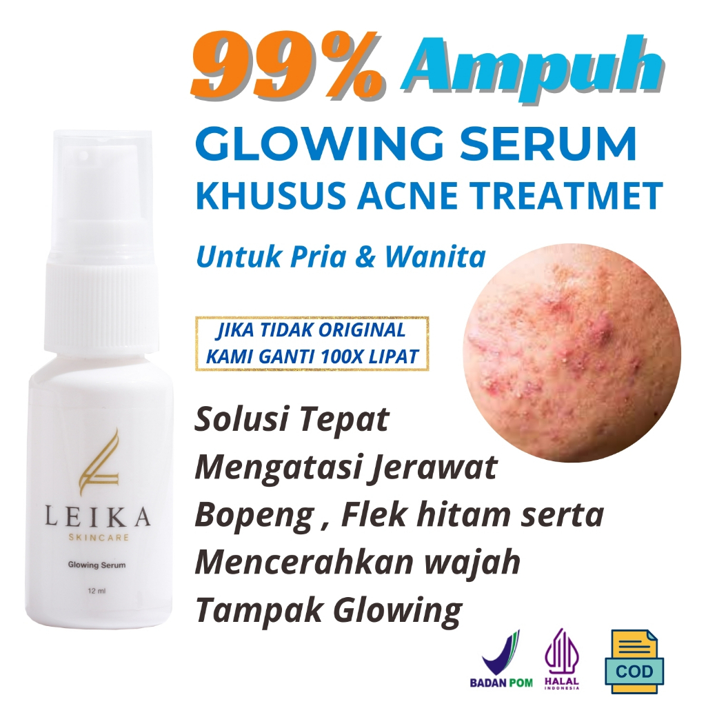 Original Serum Penghilang Jerawat dan bekas jerawat bopeng bekas jerawat menghilangkan bopeng bekas 