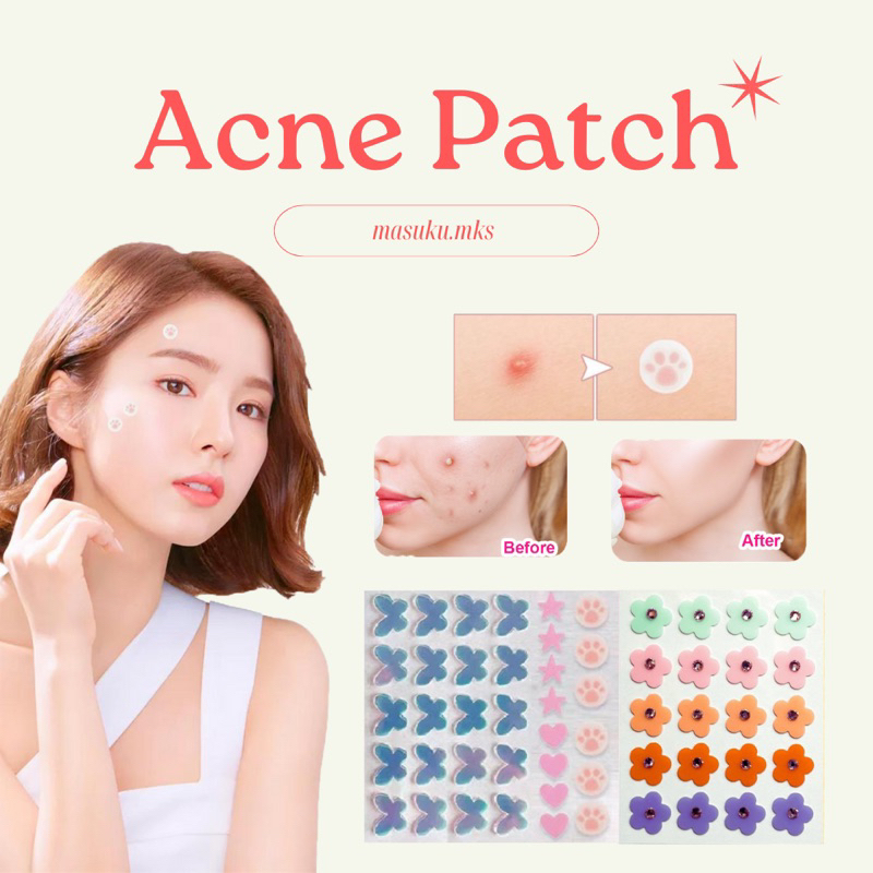 Acne Patch / Patch Jerawat / Cute Acne Patch / Acne Patch Lucu
