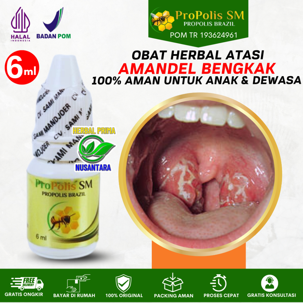 PROPOLIS SM OBAT AMANDEL ANAK DAN DEWASA HERBAL UNTUK ANAK AMANDEL BUAT ANAK UNTUK ANAK DEWASA
