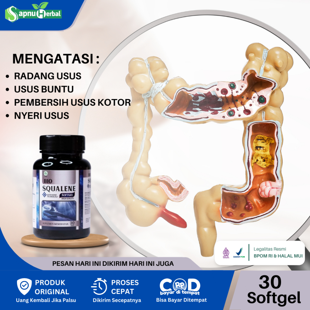 Bio Squalene Obat Usus Buntu, Usus Buntu Akut Kronis, Sakit Usus Buntu, Radang Usus Buntu, Radang Us