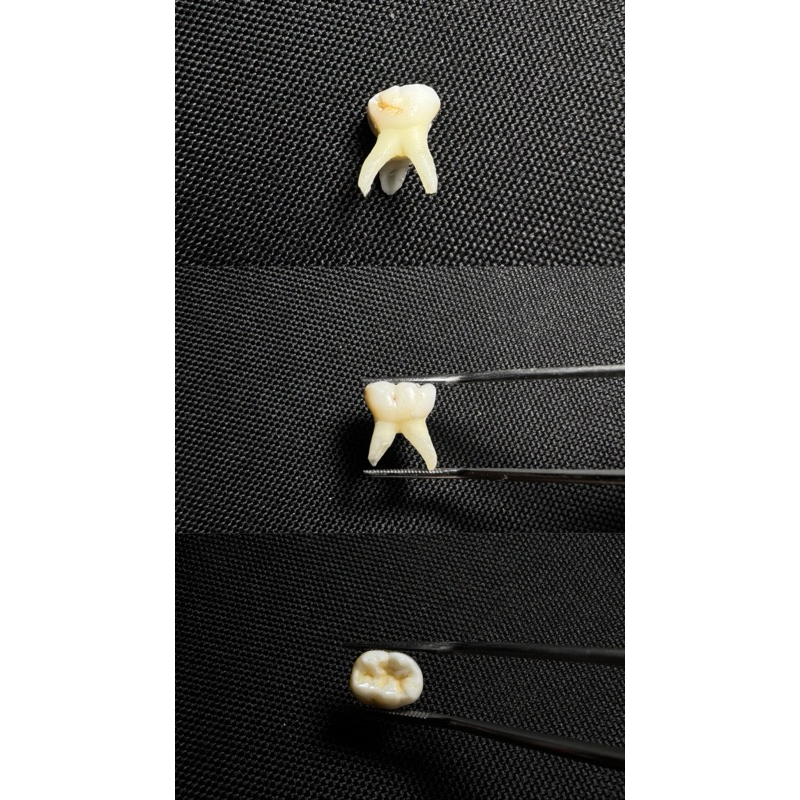 Gigi Sulung / Anak / Desidui / Bukav / Molar