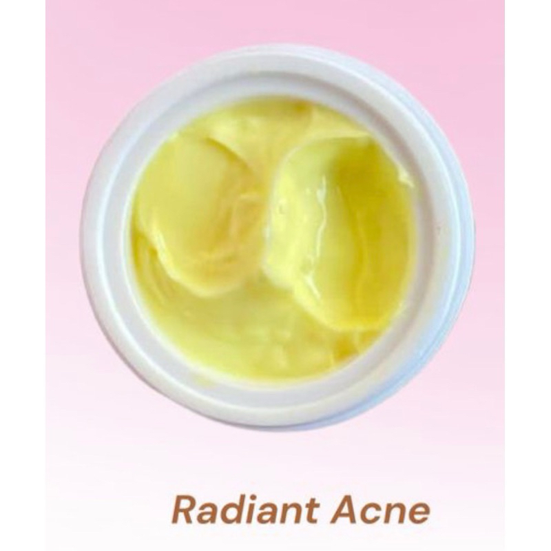 night cream radiant acne Suyo | HB DOSTING | DOSTING | HB | Handbody dosting | Pemutih Badan | Handb