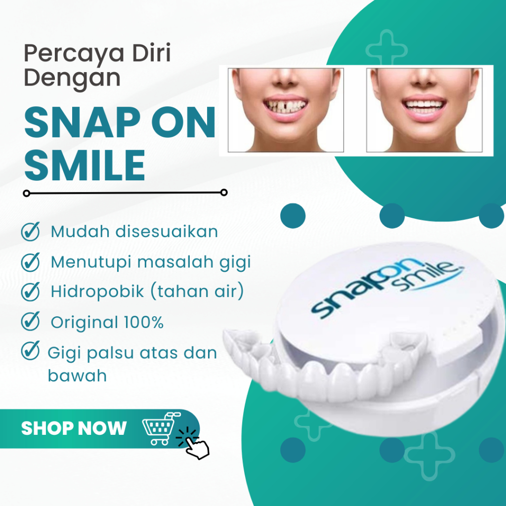 COD Snap On Smile Gigi Silikon 100 % Original Snap On Smile 1 Set atas bawah