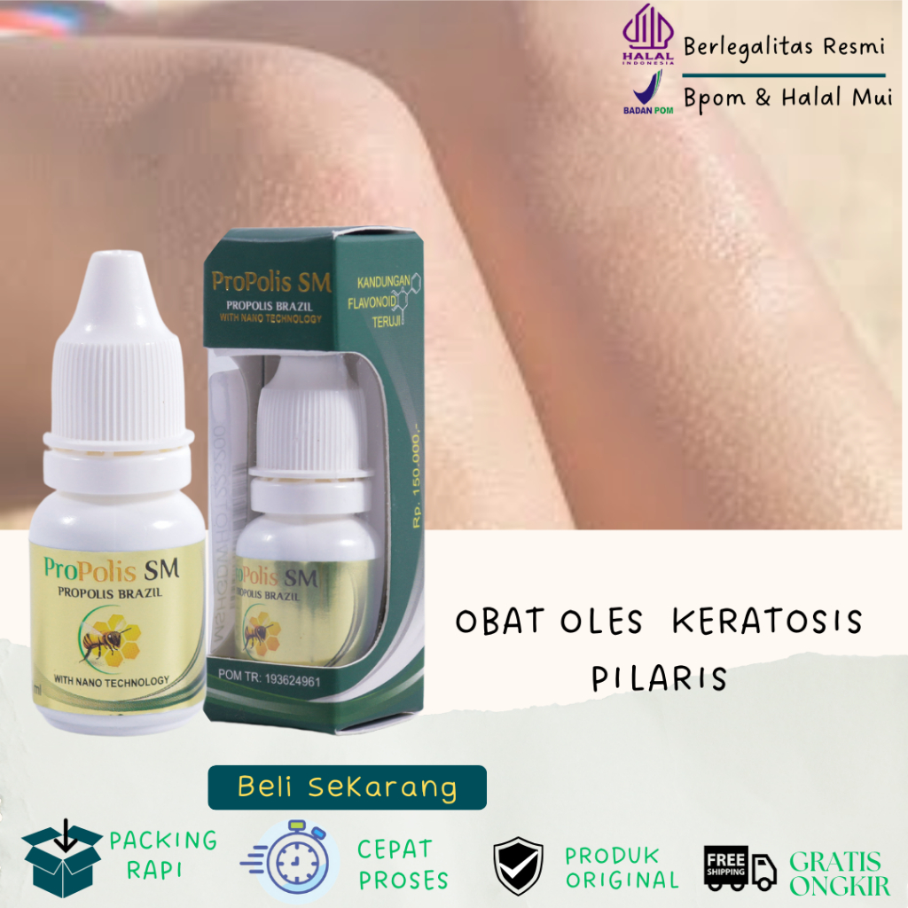 Obat Keratosis Pilaris Obat Herbal Kulit Gatal Kering dan Kasar Obat Oles Penyakit Kulit Ayam Salep 