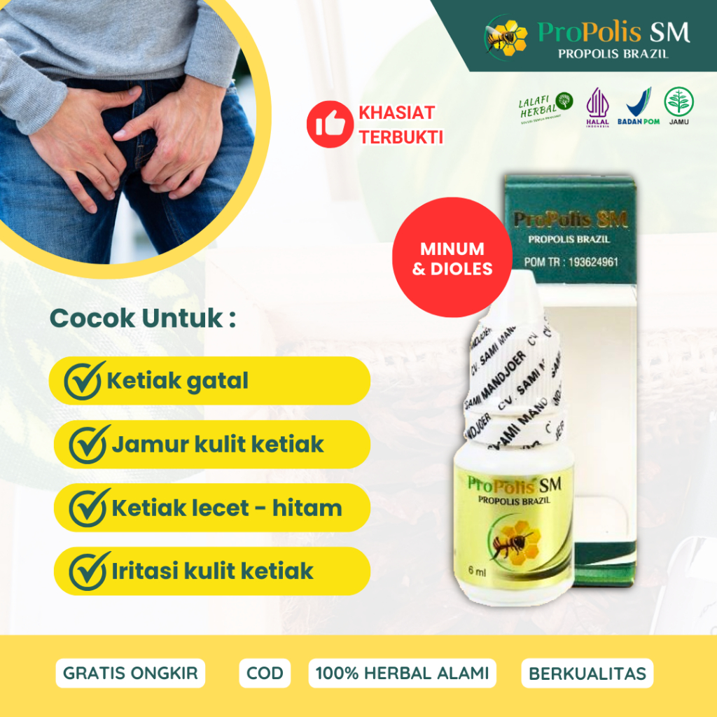 Obat Benjolan di Selangkangan Pria dan Wanita, Benjolan di Paha, Bisul di Selangkangan Herbal Propol