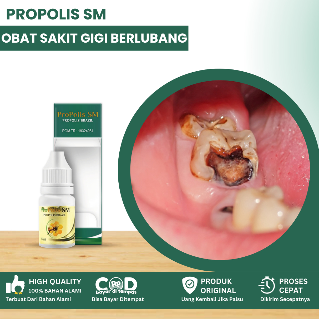 Obat Sakit Gigi Berlubang, Obat Penghilang Gusi Bengkak, Obat Sakit Gigi Keropos, Obat Gigi Goyang, 