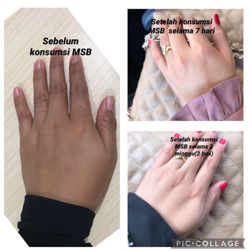 KOLAGEN MELACCA SKIN BOOSTER || BELI 2 FREE SABUN MELACCA