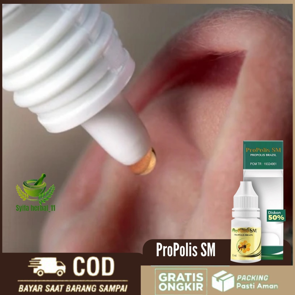 Obat Telinga Tidak Mendengar Alami, Obat Kurang Pendengaran Secara Alami, Obat Kuping Kurang Pendeng