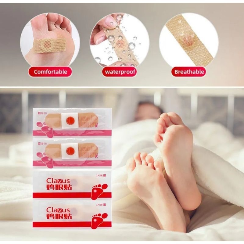 CLAVUS PLESTER KUTIL Mata Ikan Kapalan Kutil Caplak