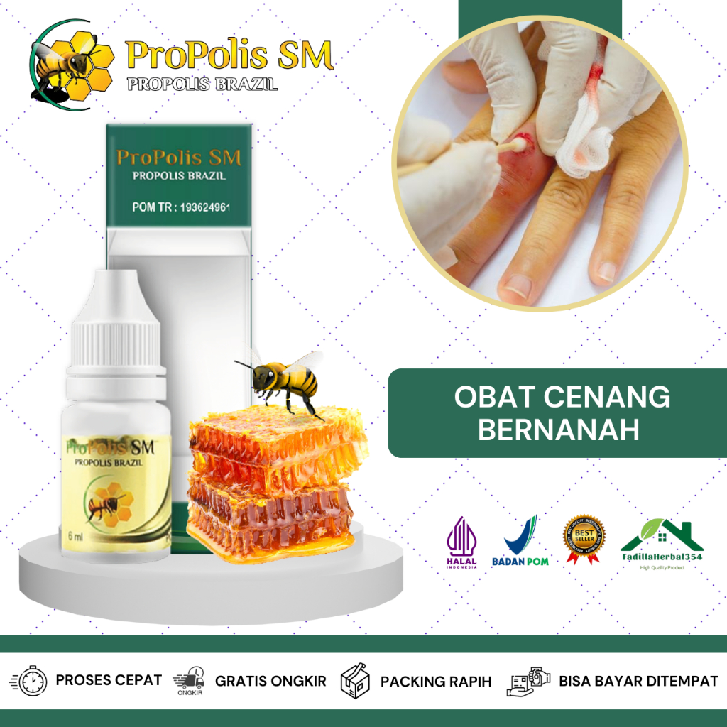Obat Cenang Bernanah, Obat Koreng Bernanah, Obat Telapak Kaki Bernanah, Obat Telapak Tangan Bernanah