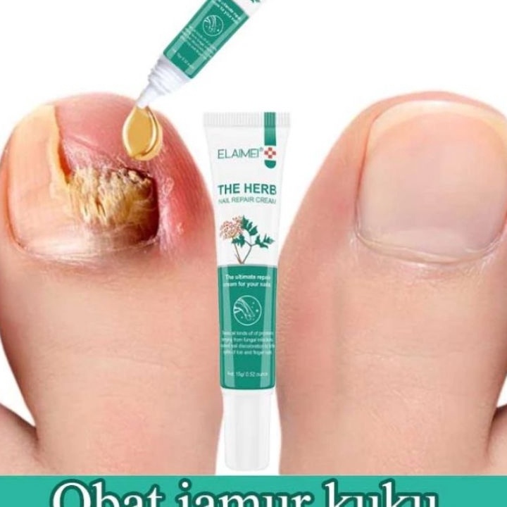 77 ELAIMEI 15gr  Obat Kuku Rusak  Jamur  Tidak Rata