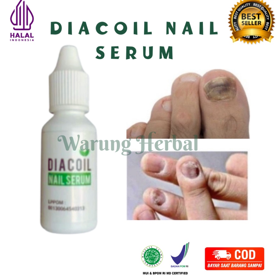 Ready Stok OBAT PENUMBUH KUKU MENGATASI CANTENGAN JAMUR KUKU DIACOIL NAIL SERUM