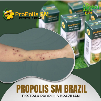 Salep Penghilang Bekas Gatal Yang Menghitam | Koreng Di Kaki - Korengan Di Selangkangan - Gatal Kada