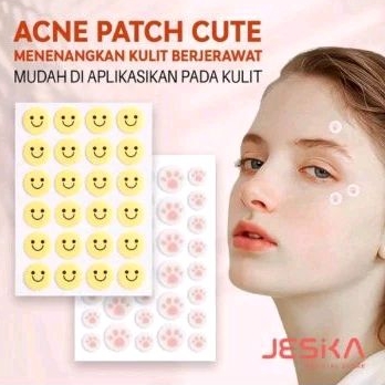 0Acne pimple patch lucu karakter bentuk bintang bunga smile kupu warna korea kulit transparan agne p