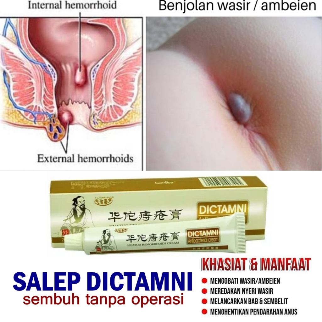 DICTAMNI SALEP OBAT WASIR ATAU EMBEYEN AMBEIEN Obat Salep DICTAMNI CREAM Salep Diktamni Dictamni Dik